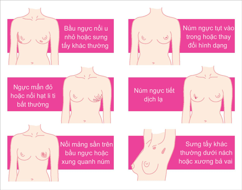 Các dấu hiệu của ung thư vú