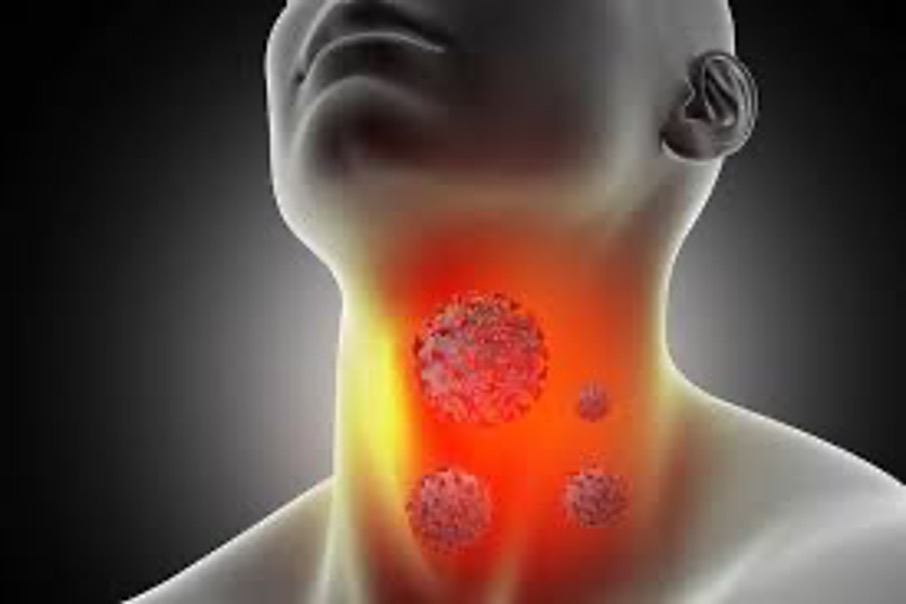 Các dấu hiệu và ung thư vòm họng có triệu chứng gì bạn nên biết